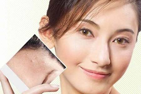 祛痘印最好的六個方法,女生淡化痘印效果看得見-易網<a href=http://www.gyfww.com/ target=_blank class=infotextkey>健康養生</a>網 祛痘印最好的六個方法,女生淡化痘印效果看得見