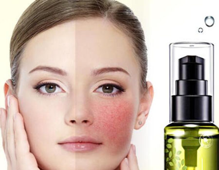 敏感肌爽膚水怎么挑 這3點需要注意