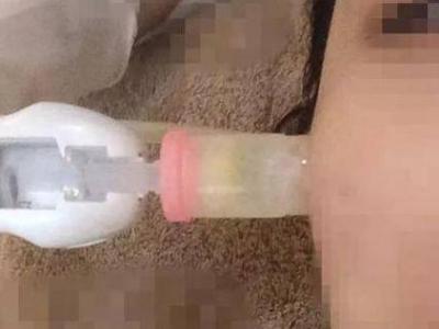 微針和水光針有什么區別？哪個治療效果會更好