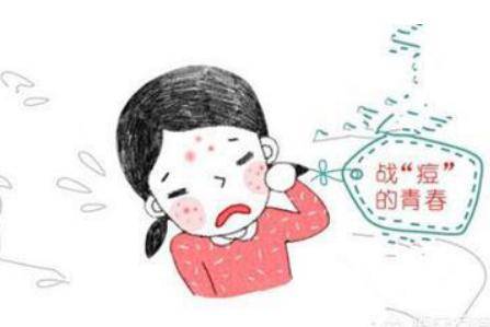 臉上長痘痘的原因，詳說青春期的女生有哪些祛痘方法