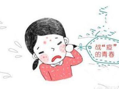 臉上長痘痘的原因，詳說青春期的女生有哪些祛痘方法