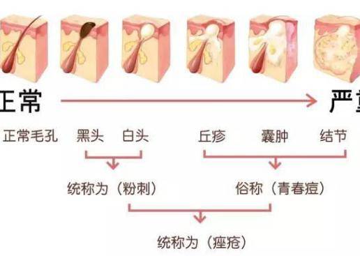 油性皮膚會(huì)有哪些肌膚問題 如何改善油性皮膚問題-易網(wǎng)健康養(yǎng)生網(wǎng) 油性皮膚會(huì)有哪些肌膚問題 如何改善油性皮膚問題