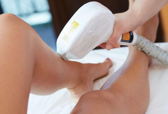 激光脫毛手術真的可以永遠去除汗毛嗎？永久去除汗毛的方法