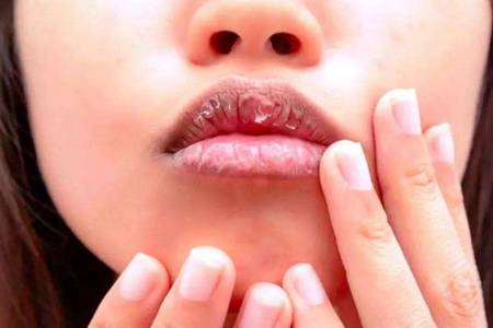 嘴唇干裂脫皮怎么辦，六個(gè)潤唇方法養(yǎng)護(hù)嬌嫩嘴唇