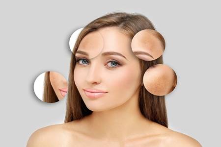 臉上起紅疙瘩怎么回事，油皮女生皮膚紅腫的護(hù)理方法