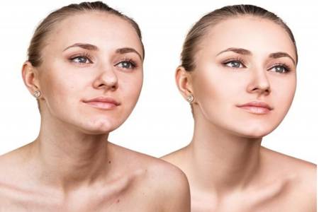 女生額頭長痘痘是什么原因，一按就痛要怎么調(diào)理