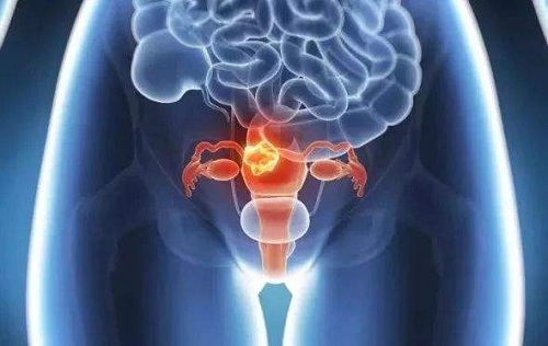 怎樣保養(yǎng)卵巢和子宮？日常注意這些事
