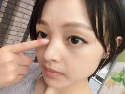 鼻子上長痘痘的原因，減少鼻頭長痘少做這三件事