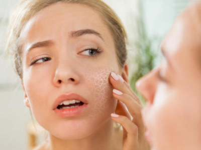 中性皮膚有什么特征？中性皮膚如何保養(yǎng)比較好？