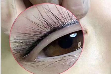 種睫毛效果怎樣能保持多久  女性移植睫毛需要多少錢一次