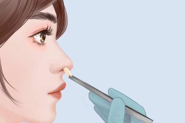 隆鼻手術(shù)的風(fēng)險大嗎