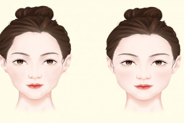 如何做臉部填充