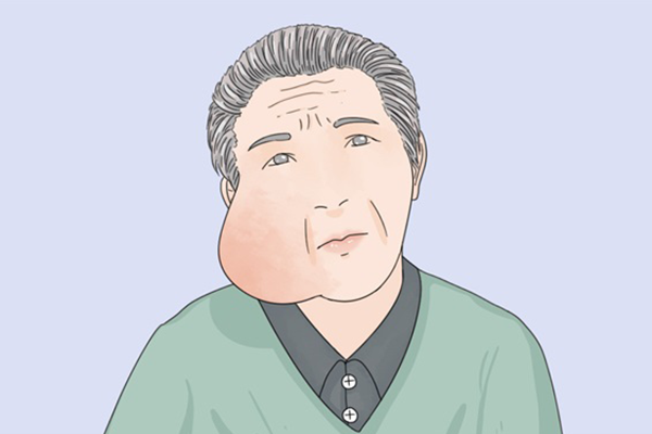 臉部腫了怎么快速消腫