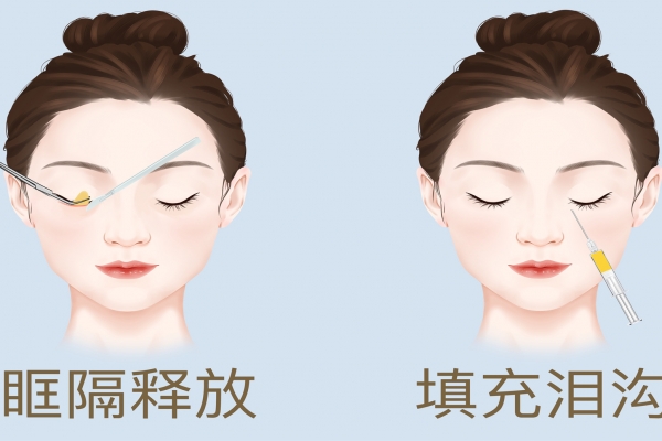 整容都包括哪些項目