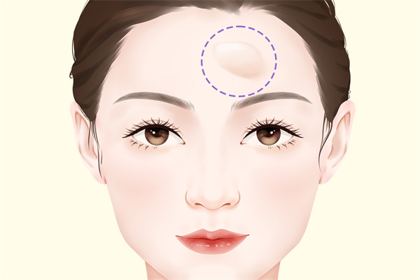 額頭有皺紋怎么回事