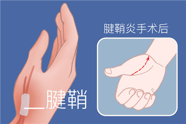 疤痕皮膚修復方法