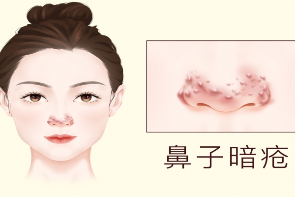 臉色暗沉發(fā)黑怎么才能變白