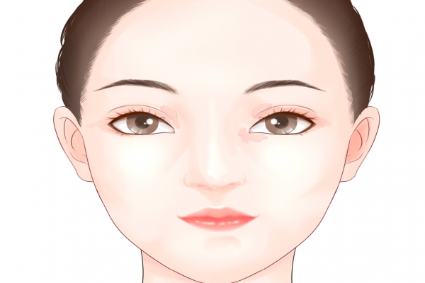 什么是激素臉,怎么造成的