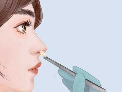 隆鼻手術(shù)的風(fēng)險(xiǎn)大嗎