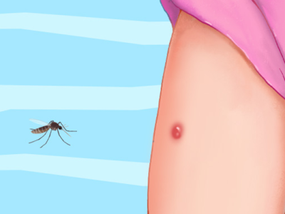 身上很多紅疙瘩、很癢怎么回事