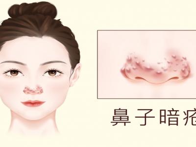 臉色暗沉發(fā)黑怎么才能變白