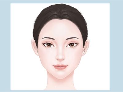 割雙眼皮好不好