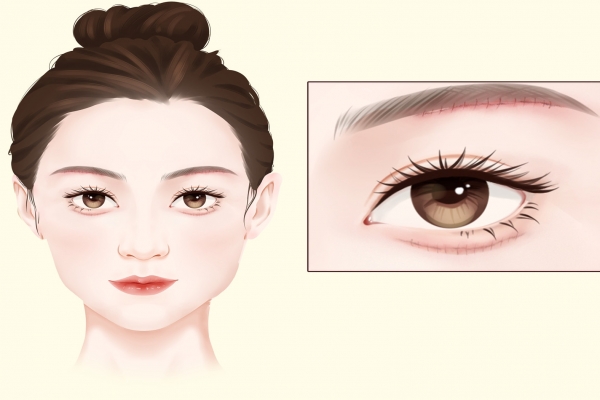 眼袋怎么消除簡單方法