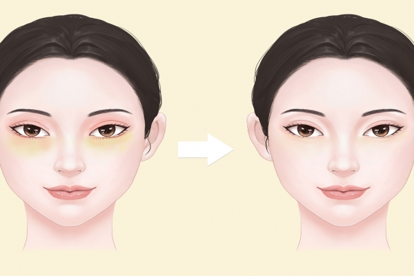 眼袋怎么消除簡單方法