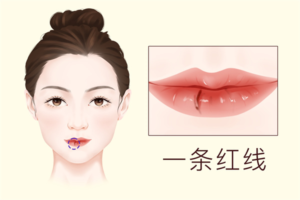 嘴唇整容費用是多少