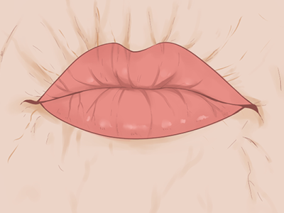 嘴唇整容費(fèi)用是多少