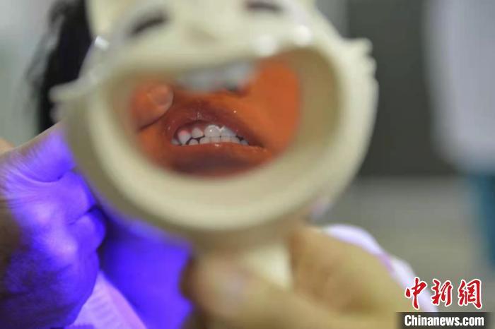 瘋狂的牙套：“9塊9包郵”就能實現整牙自由？