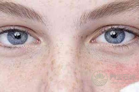 春天預(yù)防過(guò)敏的方法有哪些?