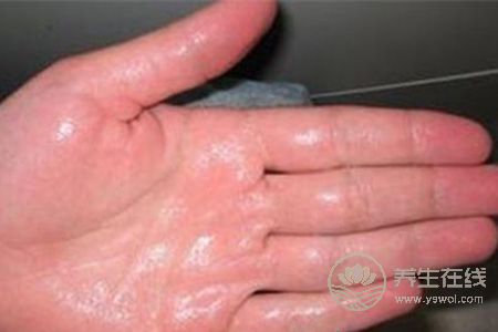 夏季手腳出汗該吃什么食物?