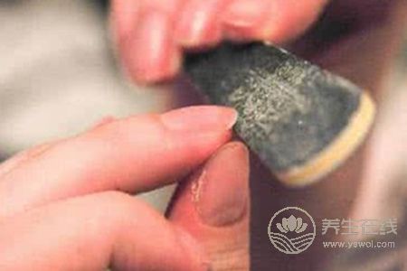 冬季該怎樣預防凍瘡? 冬季該怎樣預防凍瘡?