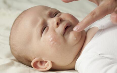 春季如何預(yù)防小兒麻疹？