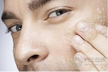 秋燥傷皮膚,4個(gè)妙招杜絕干癢上身 秋燥傷皮膚,4個(gè)妙招杜絕干癢上身