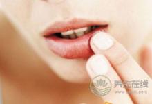 預防秋季爛嘴角的方法有哪些