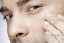 秋燥傷皮膚，4個妙招杜絕干癢上身