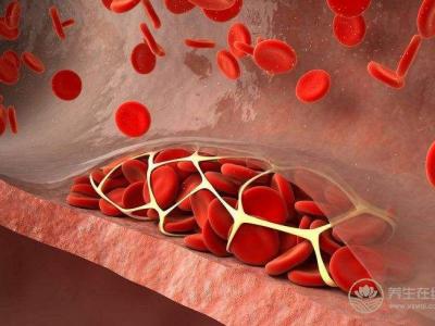 秋季如何預防血栓形成