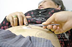 專家支招：立秋后要小心陰暑