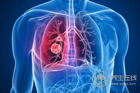 老年人霜降如何養(yǎng)生?老年人霜降如何預(yù)防肺炎呢?-易網(wǎng)健康養(yǎng)生網(wǎng) 老年人霜降如何養(yǎng)生?老年人霜降如何預(yù)防肺炎呢?