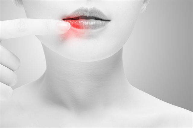 春天嘴唇經常干裂怎么辦？這些妙招幫你緩解