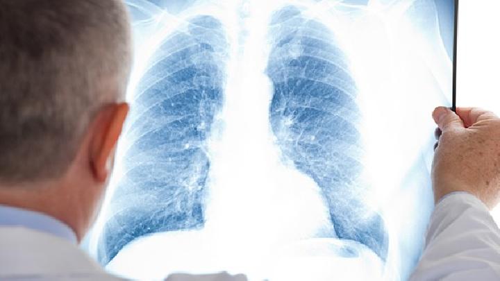 春季鼻炎患者要注意什么事項 鼻炎患者需格外注意這些事項