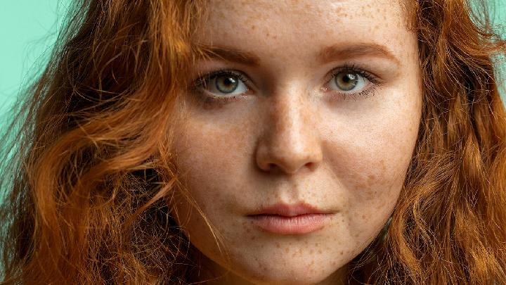 春天花粉過敏怎么治療 7個處理花粉過敏小竅門很有效