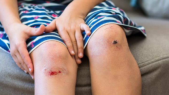 小孩子應(yīng)該怎么養(yǎng)胃好 兒童養(yǎng)胃健康常識(shí)早知道