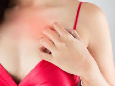 怎么調理花粉過敏體質 花粉過敏主要有三種表現