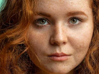 春天花粉過敏怎么治療 7個處理花粉過敏小竅門很有效