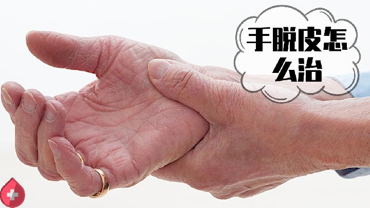 冬天手上皮膚發(fā)黑?5種原因要了解-易網(wǎng)健康<a href=http://www.gyfww.com/jkys/ target=_blank class=infotextkey>養(yǎng)生</a>網(wǎng) 冬天手上皮膚發(fā)黑?5種原因要了解