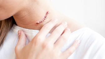 冬天手心出汗？6個情況要知曉