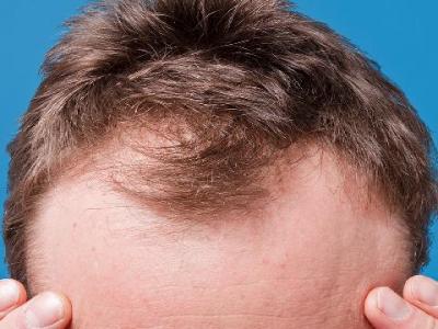 冬天臉發燙發紅的原因是什么 冬天臉發紅發燙怎么護理